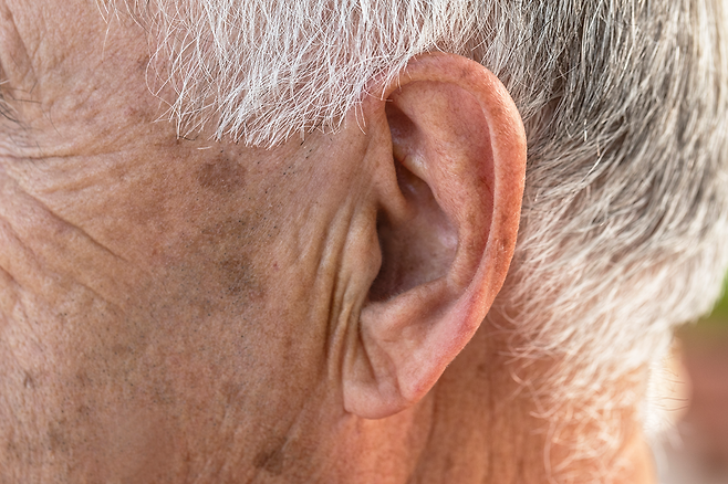 귓불에 사선으로 생긴 주름을 가리키는 ‘프랭크 징후’가 심뇌혈관질환 위험과 관련 있음을 규명한 연구 결과가 나왔다. 게티이미지