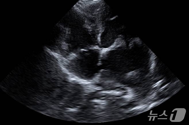 강아지 초음파 검사 결과 심방중격 부위가 터진 모습(더케어동물의료센터 제공) ⓒ 뉴스1