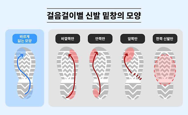 걸음걸이별 신발 밑창의 모양. 제일정형외과병원 제공