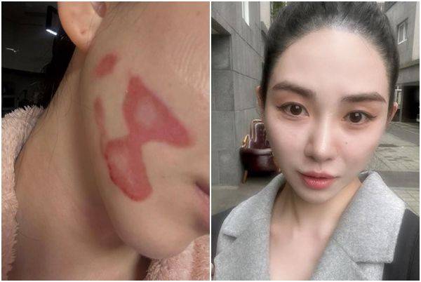 권민아. 사진=권민아 인스타그램