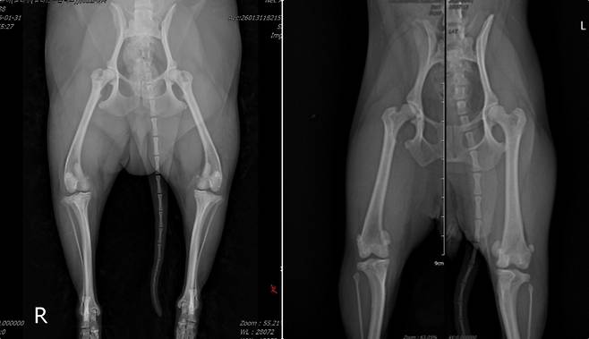 왼쪽처럼 촬영 시 무릎뼈(슬개골)와 허벅지뼈가 안쪽으로 돌아가 각도 측정이 어렵다. 오른쪽 사진처럼 허벅지뼈 정렬을 맞춰 촬영해야 변형 정도와 수술 위치를 정밀하게 확인할 수 있다(바르고바르개 제공). ⓒ 뉴스1