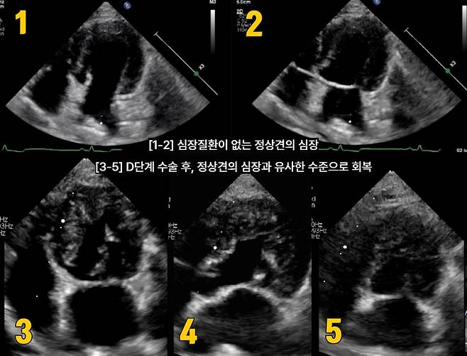 D단계 수술 후, 정산견의 심장과 유사한 수준으로 회복된 반려견의 심장초음파(넬동물의료센터 제공) ⓒ 뉴스1