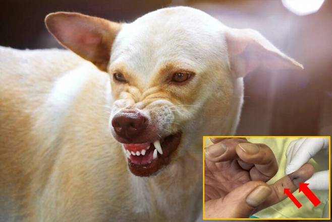 61세 남성이 반려견에게 손가락을 물린 뒤 사망한 사례가 보고됐다. 배경사진=게티이미지뱅크/우측 하단 사진='Cureus'