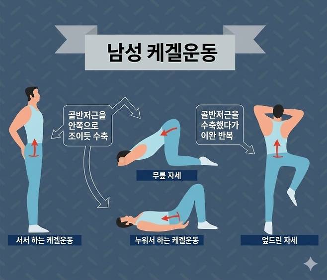 골반저근을 강화하는 케겔운동(케겔 체조) 방법을 설명한 일러스트. 조루 관리와 성기능 개선에 도움이 되는 운동으로 알려져 있다. 123RF 자료를 바탕으로 제작