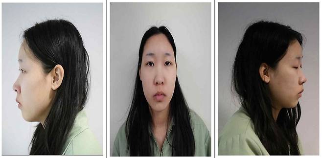 서울 강북구 모텔 연쇄살인 피의자 김소영(20)의 머그샷. 서울북부지방검찰청 제공