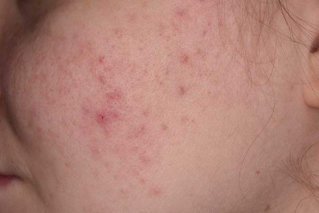 장 건강이 악화되면 전신에 영향을 준다. /클립아트코리아