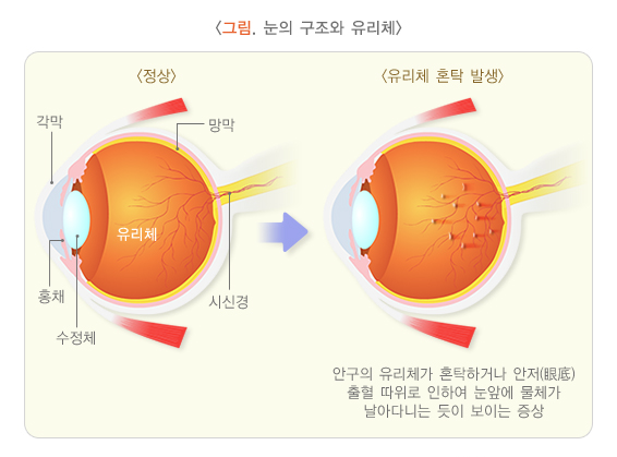 질병관리청