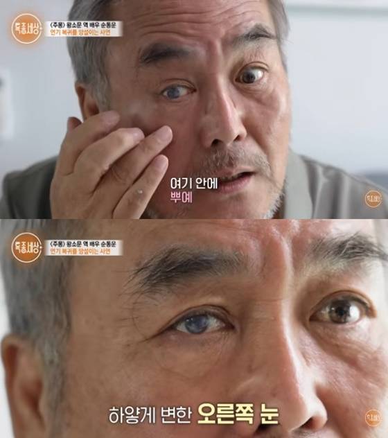 순동운/사진=유튜브 특종세상