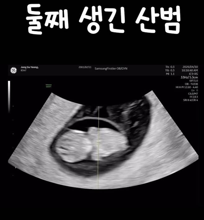 산범 초음파 / 사진 = 산범 SNS