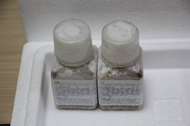 대변이식용 대변 / 사진제공= 부천성모병원