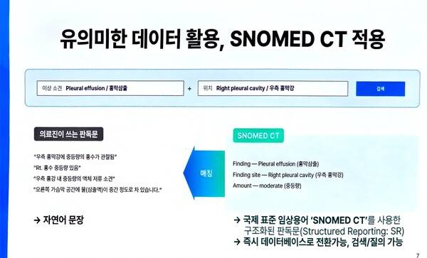 딥노이드 의료AI는 단순 검사 판독이 아닌 판독 소견서를 자연어 문장으로 만들어 판독문을 의료진에게 제공한다. / 딥노이드