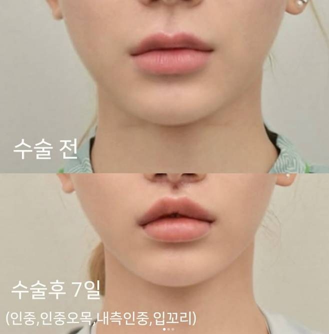 /사진=맹승지 SNS