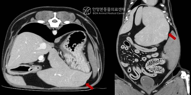 CT 검사로 확인한 간 종괴(병원 제공) ⓒ 뉴스1