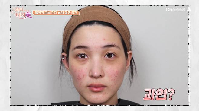 사진=채널A '뷰티 클리닉 터치미'