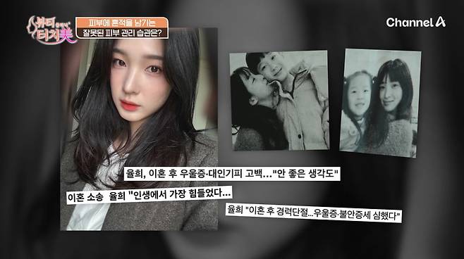 사진=채널A '뷰티 클리닉 터치미'