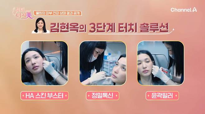 사진=채널A '뷰티 클리닉 터치미'