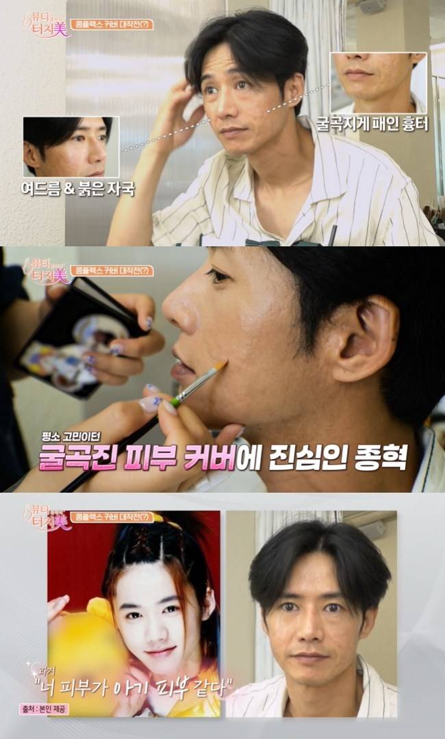 사진=채널A ‘뷰티 클리닉 터치미’ 캡처