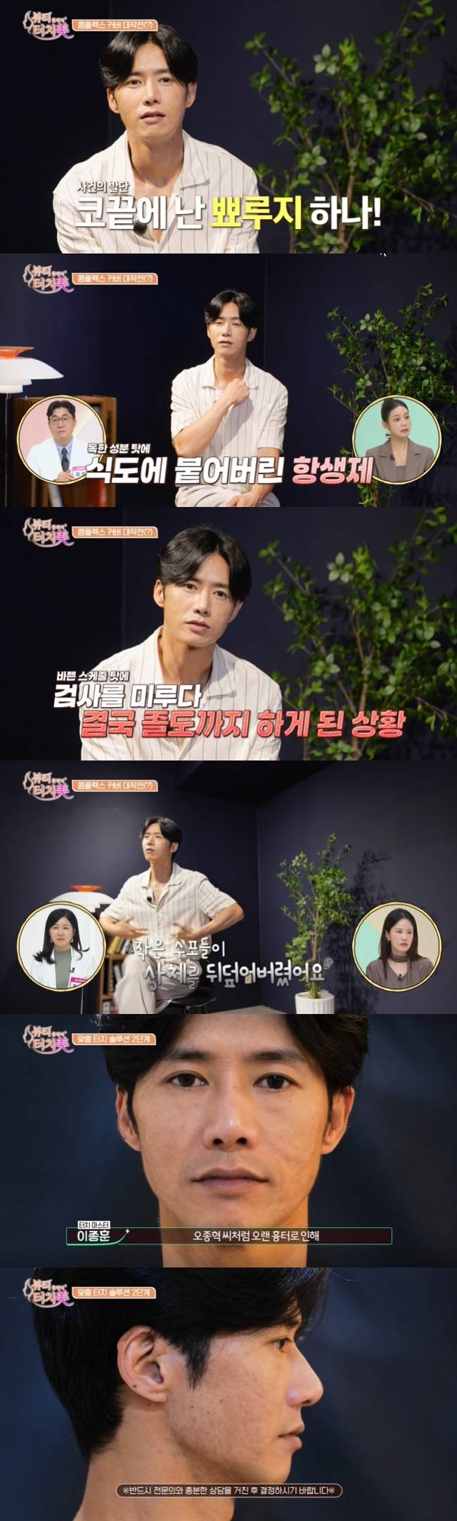 사진=채널A ‘뷰티 클리닉 터치미’ 캡처