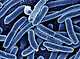 출처: 출처 : E. coli outbreak widens to 15 states, CDC says